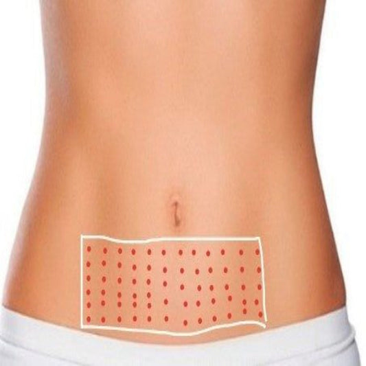 Hyaluron Pen Fat Dissolve Training in action—esthetician demonstrating non-invasive fat reduction on jawline with precision technique.