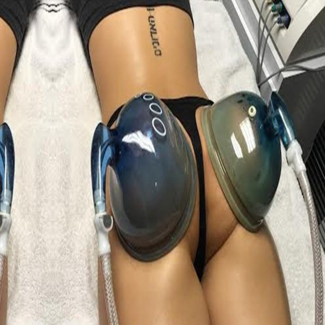 How Long Does Vacuum Therapy Buttocks Last: Ultimate Duration Guide