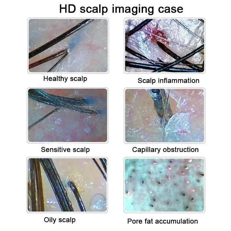 Professional Scalp Analyzer: Discover Scalp Health – Luxe Beauty & Body Co.