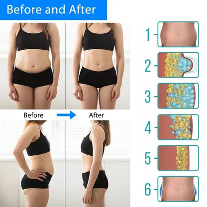 Cryolipolysis Machine